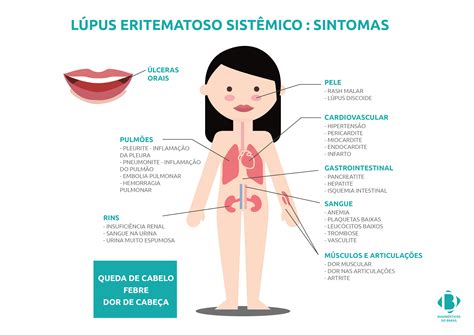 sintomas de lupus en mujeres - pontos de coleta mercado livre
